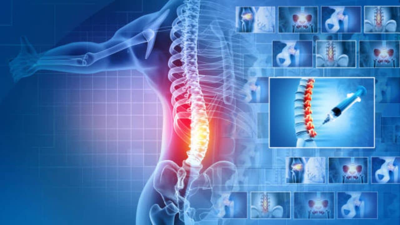Text Neck Syndrome:অতিরিক্ত মোবাইলের ব্যবহারে বাড়ছে বিপদ, মেরুদণ্ড-ঘাড় বেঁকে যাবে অচিরেই যদি না এখনই সচেতন হন