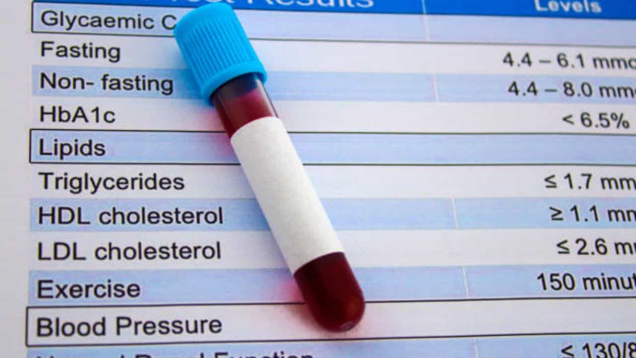 HDL Cholesterol: হঠাৎ করে ভাল কোলেস্টেরলের মাত্রা কমে গিয়েছে? ওষুধ ছেড়ে লাইফস্টাইলের উপর জোর দিন