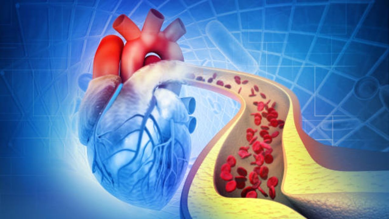 কোলেস্টেরলের সমস্যা আজকাল খুব কম বয়স খেকে আসছে। এর জন্য় দায়ী আমাদের জীবনযাত্রা। রোজকার খাদ্যাভ্যাস, জীবযাত্রার কারণেই বাড়ছে শরীরের একাধিক সমস্যা। যে কারণে বাড়ছে ডায়াবেটিস, ট্রাইগ্লিসারাইড, কোলেস্টেরলের মত সমস্যা 