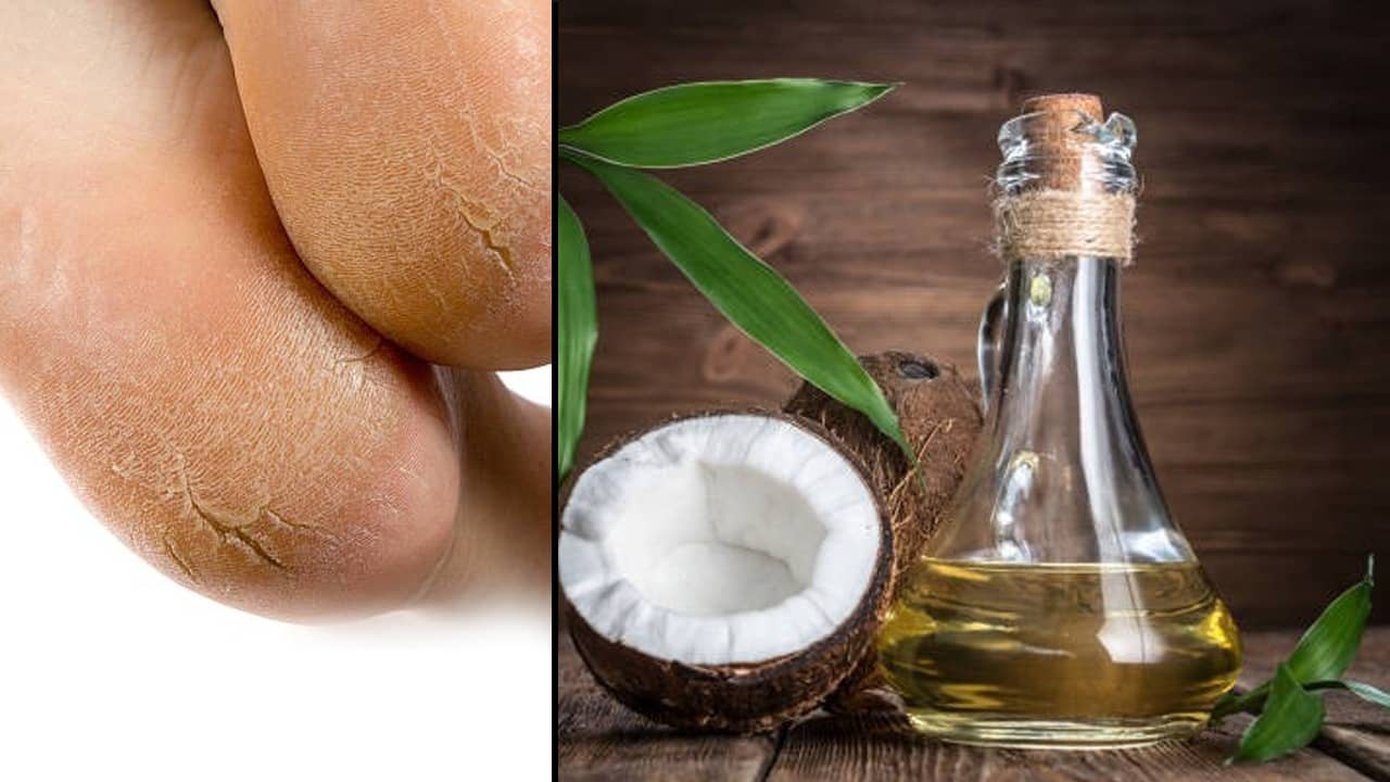Cracked heels: ঠান্ডা পড়েনি কিন্তু ডিসেম্বর পড়তেই পা ফাটতে শুরু করেছে? এখন থেকেই মেনে চলুন এই টোটকা