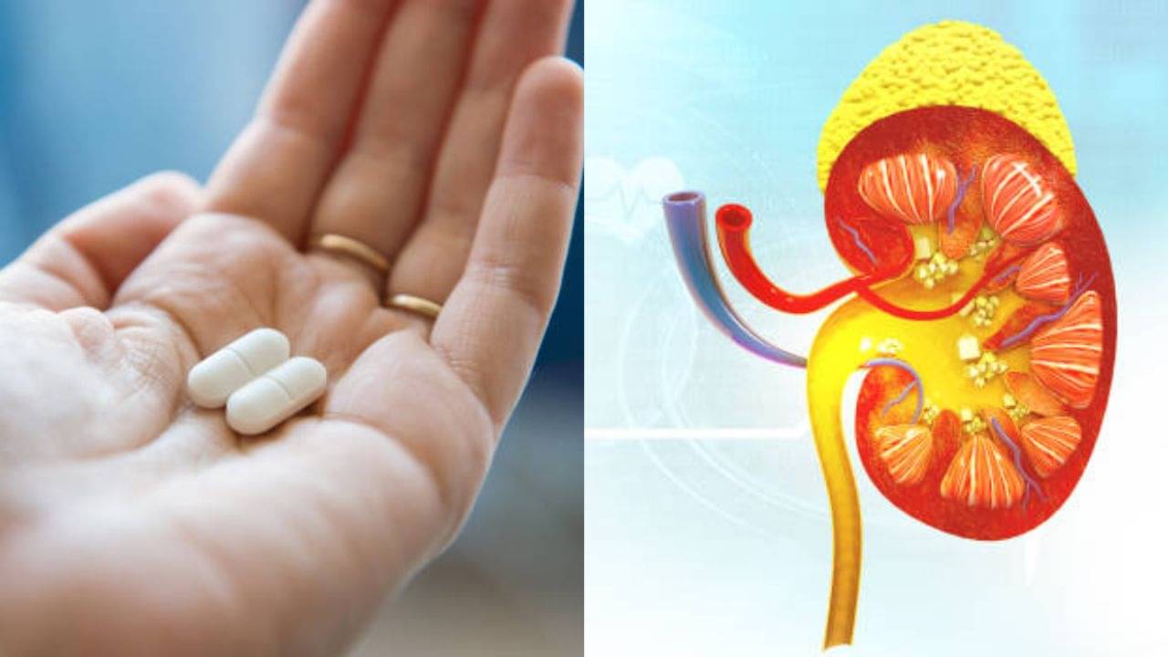 Kidney Stone: গাঁটের ব্যথা কমাতে ক্যালশিয়ামের ওষুধ খাচ্ছেন? এতে কিডনিতে পাথর জমছে না তো!