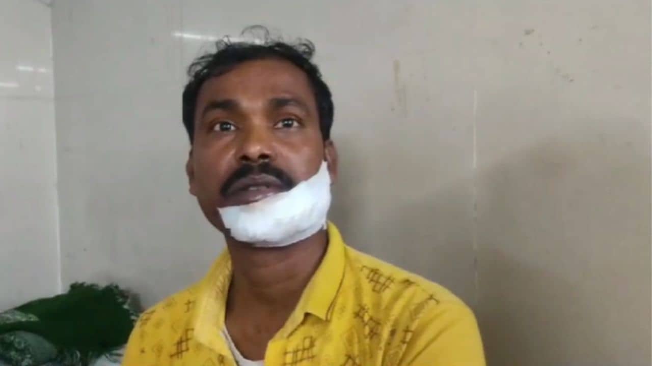 Kalna: স্রেফ একটা টান, চলন্ত বাইকেই কান থেকে খুতনি পর্যন্ত ফালা হয়ে কেটে গেল!