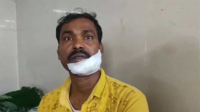 Kalna: স্রেফ একটা টান, চলন্ত বাইকেই কান থেকে খুতনি পর্যন্ত ফালা হয়ে কেটে গেল!