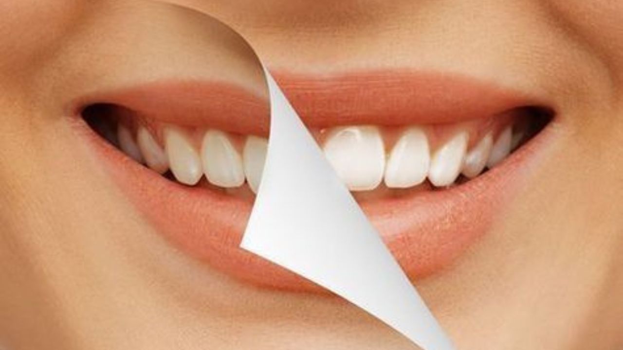 আর স্ট্রবেরিতে রয়েছে এক ধরনের উপাদান যা দাঁতের এনামেল তৈরি করতে সাহায্য করে।  এ ছাড়া আমলকি, পেয়ারা মাড়ি শক্ত করতে সাহায্য করে। (ছবি:Pinterest)