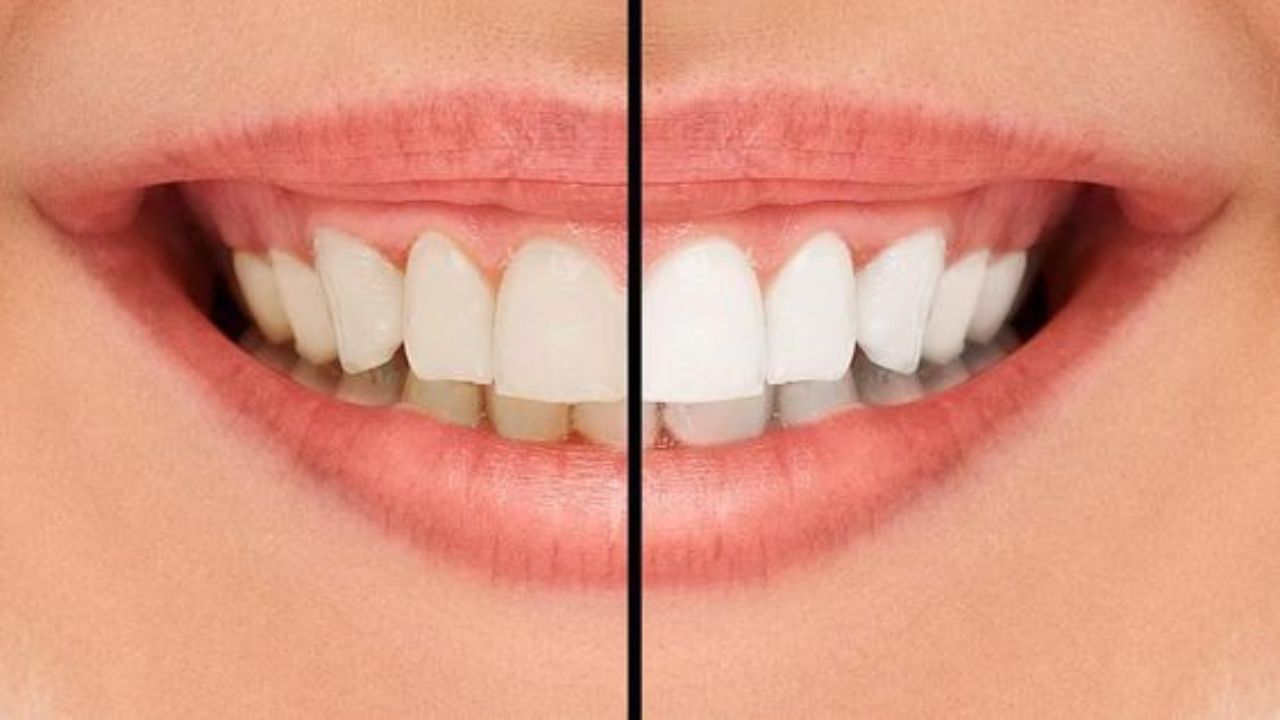 এ ছাড়া বেশি করে ফল খেতে হবে। আপেল, স্ট্রবেরি, আমলকি বেশি করে খান। এইসব  ফলে রয়েছে  ভরপুর ভিটামিন সি। এ ছাড়া আপেলে  রয়েছে পটাশিয়াম। (ছবি:Pinterest)