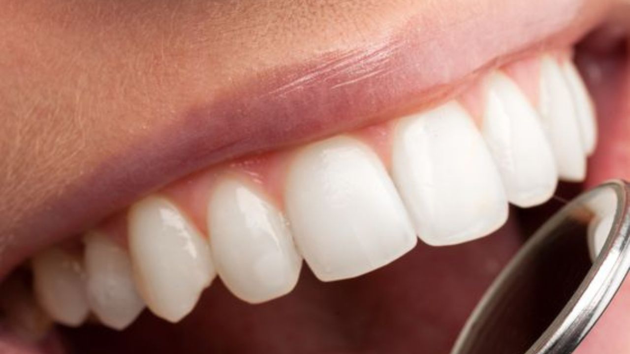 সুস্থ থাকতে শাকসবজি খাওয়ার পরামর্শ দেন বিশেষজ্ঞরা। তবে জানেন কি দাঁত পরিষ্কার করতেো সাহায্য করে শাকসবজি। (ছবি:Pinterest)