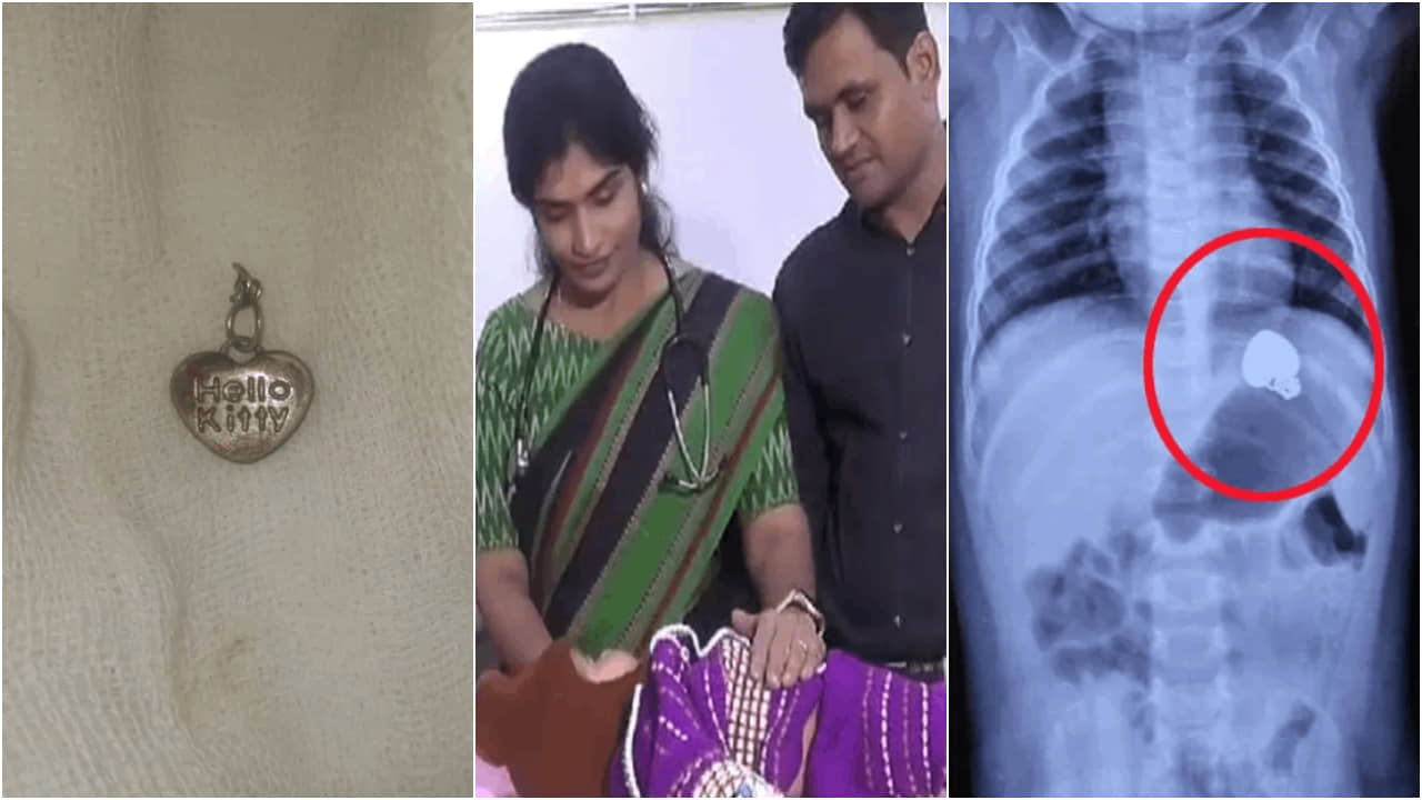 Telangana: কাটাছেঁড়া না করেই ৬ মাসের শিশুর পেট থেকে বের হল লকেট, কীভাবে জানেন?