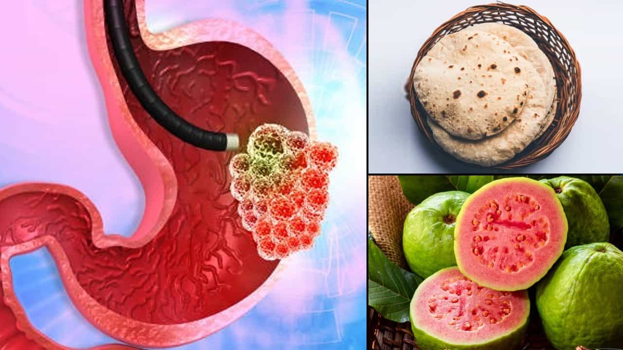 Foods To Beat Acidity: খেলেই পেটে অ্যাসিড, তীব্র বুক জ্বালা? রোজ দুপুরে এসব খাবার খেলে সমস্যা অনেকটাই কমবে Foods To Beat Acidity: খেলেই পেটে অ্যাসিড, তীব্র বুক জ্বালা? রোজ দুপুরে এসব খাবার খেলে সমস্যা অনেকটাই কমবে