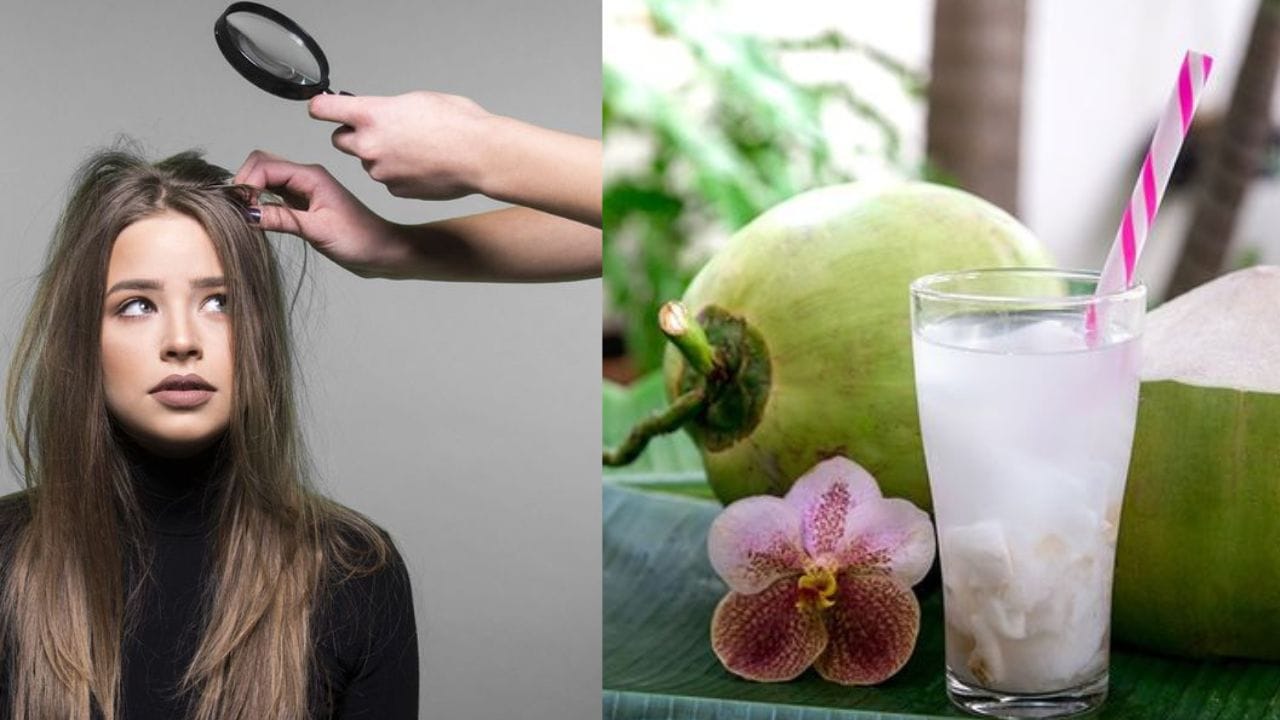 মুঠোমুঠো চুল উঠছে? ডাবের জলেই লুকিয়ে সমাধান Bengali News Check