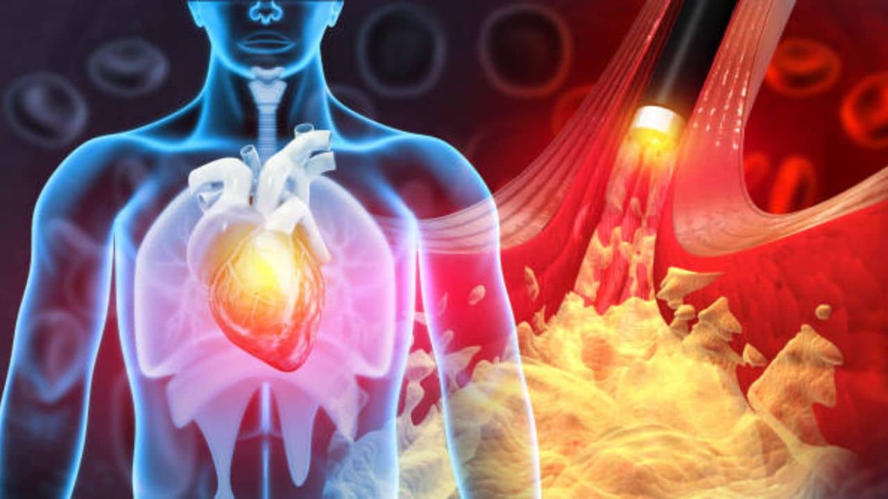 উইকএন্ডে বাইরের খাবার বেশি খান, নিশ্চুপে কোলেস্টেরল বাড়ছে, জানেন তো?