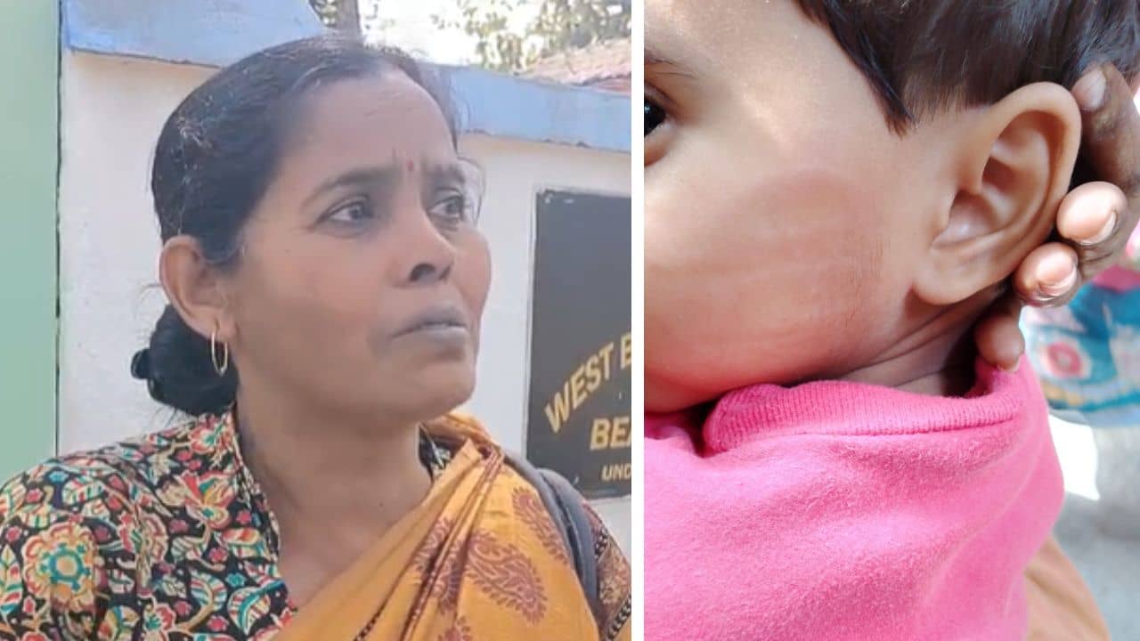Child Beaten: ৩ বছরের শিশুর গালে পাঁচ আঙুলের দাগ, অভিযুক্ত তৃণমূল নেত্রী দিদিমণি