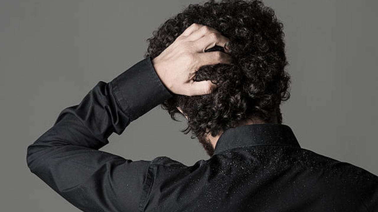 অনেকেই ঘরোয়া টোটকায় ভরসা করতে চান। লেবুর রস ব্যবহার করে খুশকি কমানোর পদ্ধতি বেশ জনপ্রিয়। ঘরে বসেই লেবুর রস ব্যবহার করে খুশকি দূর করতে পারেন আপনি