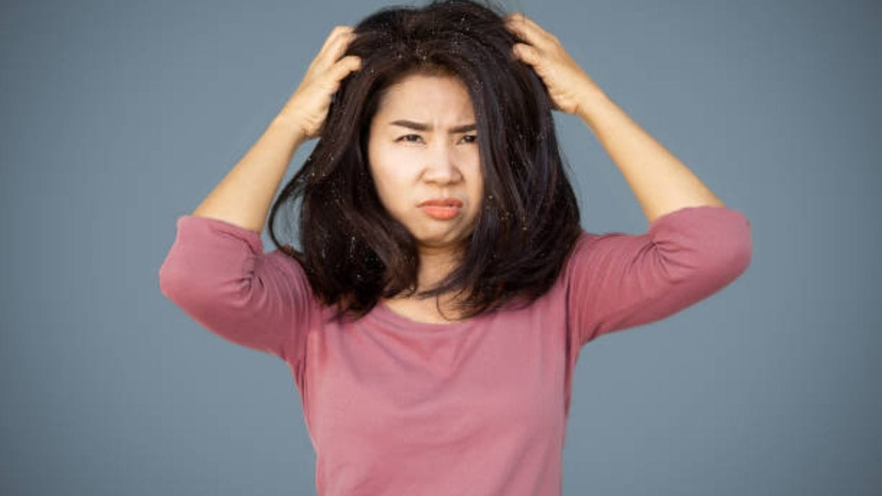 শীতকাল এলেই চুলের নানা সমস্যা শুরু হয়ে যায়। কারও কারও অতিরিক্ত চুল পড়তে থাকে। কারও মাথায় খুশকির সমস্যা অনেকটাই বাড়ে। আর শীত বিদায় নেওয়ার সময়ও নানা ঝামেলা হয় 