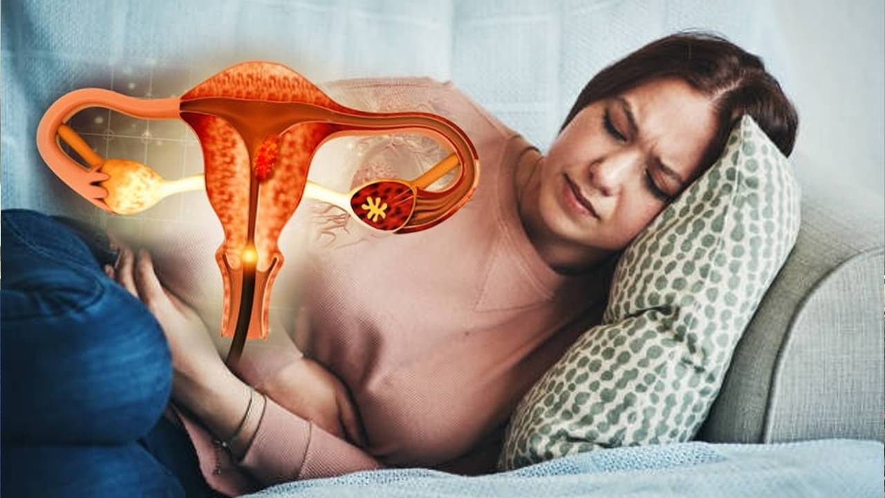 Endometriosis Awareness Day: এন্ডোমেট্রিওসিসে আজকাল অনেক মহিলাই ভুগছেন, যে ৫ অভ্যাস রপ্ত করলে সমস্যা থেকে কিছুটা হলেও রেহাই পাবেন
