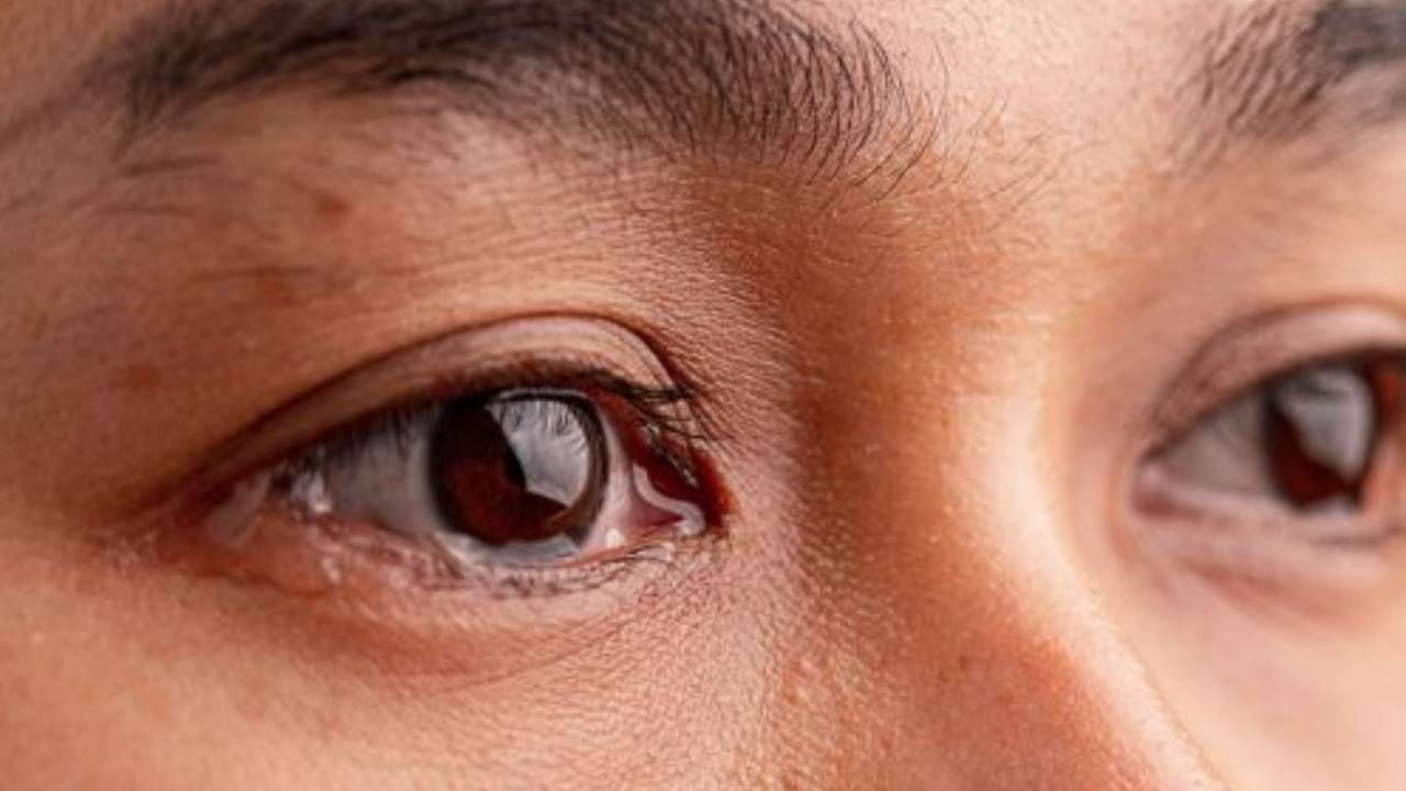 এর পাশাপাশি বিভিন্ন শারীরিক সমস্যা, অ্যালার্জির মতো বিপদ তো রয়েইছে। এ সবের হাত থেকে চোখকে সুস্থ রাখা দৃষ্টিশক্তি বজায় রাখা নিয়ে চিন্তার প্রয়োজন রয়েছে। 