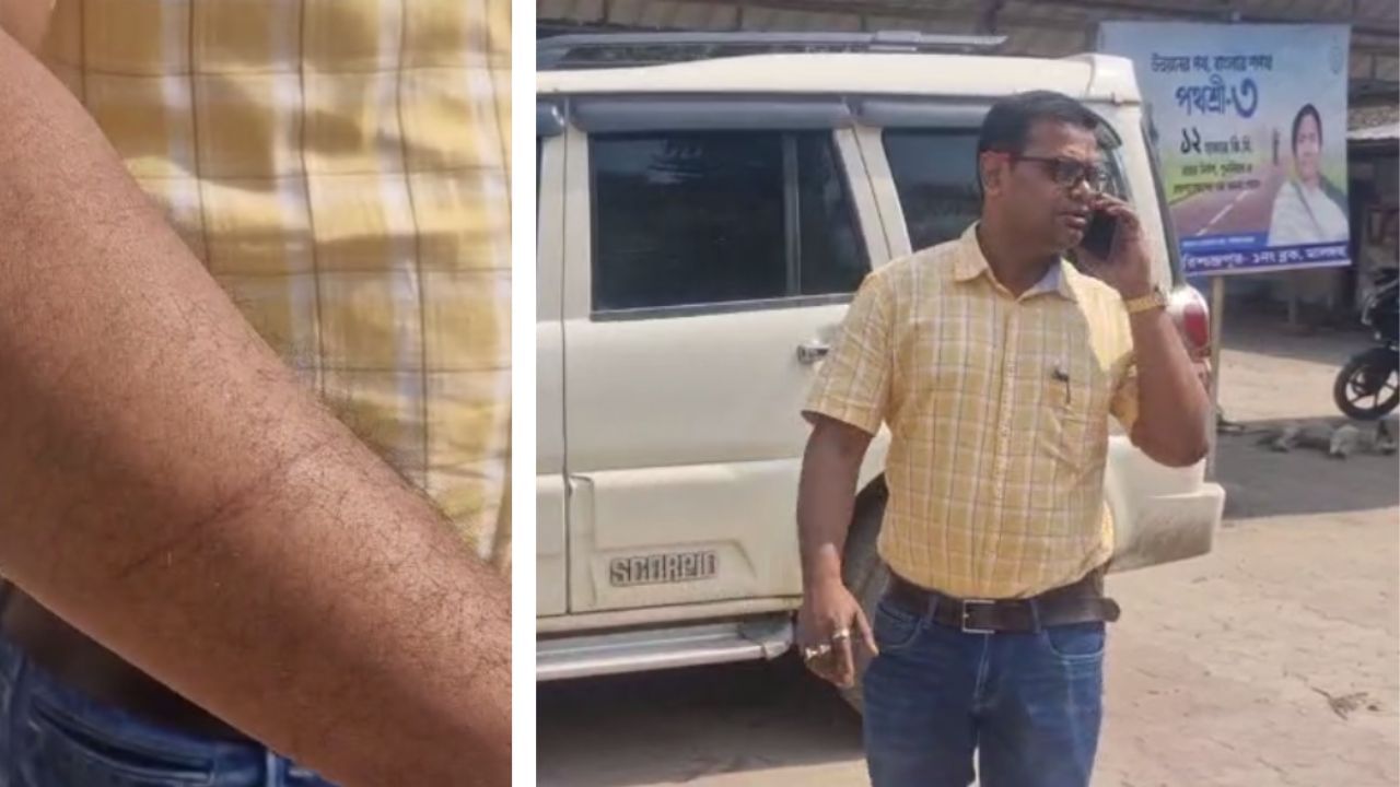 Maldah: রাস্তার উদ্বোধন করবেন কে? জোটের সঙ্গে TMC-র হাতাহাতিতে আহত বিডিও