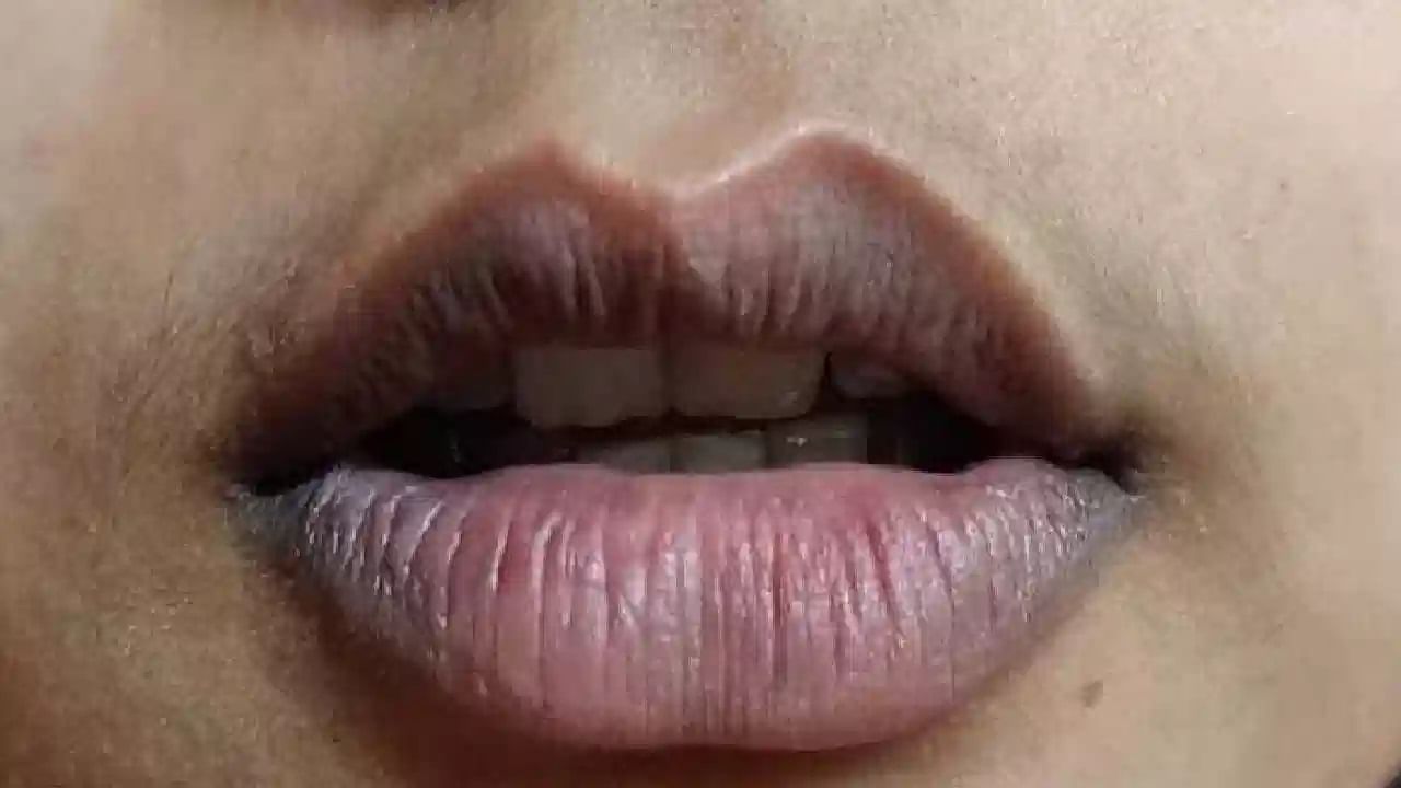dark lips 6