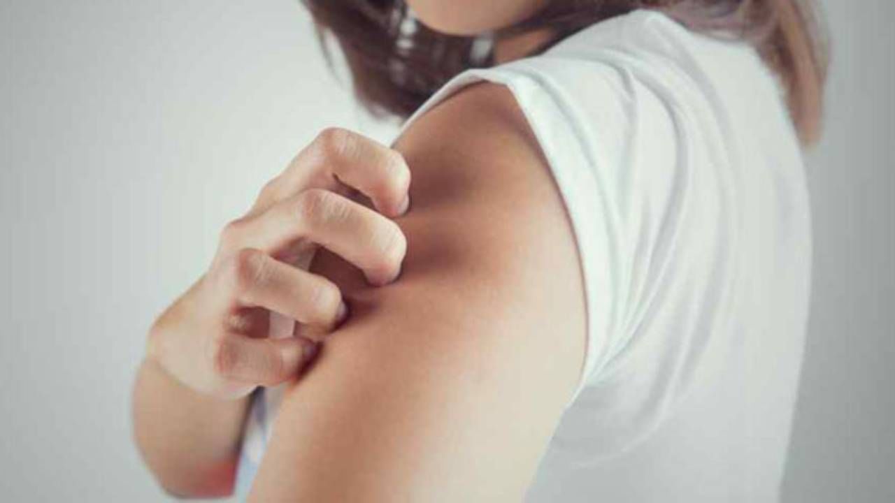 বসন্ত শুকিয়ে আসার সময় গা চুলকোবেই। আর তাতে নখ লাগালেই ত্বকে স্থায়ীভাবে পক্সের দাগ থেকে যেতে পারে। ছড়াতে পারে সংক্রমণও। তাই শিশুদের নখ ছোটো করে কেটে দিন এই সময়। এমনকী চুলকানি কমাতে চিকিৎসকের পরামর্শ মেনে অলিভ অয়েল বা ক্যালামাইন লোশন লাগান বারে বারে।