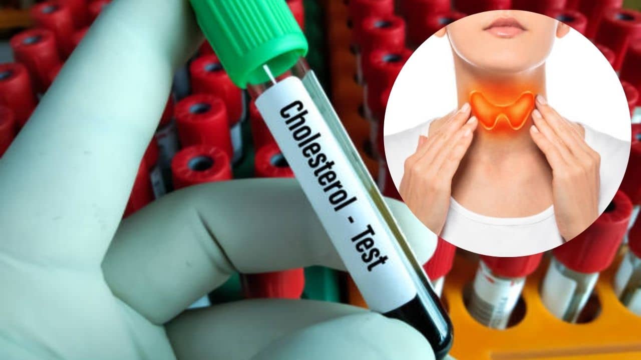 Thyroid-Cholesterol: বাড়ির তৈরি খাবার খেয়েও কোলেস্টেরলে ভুগছেন? একবার থাইরয়েড পরীক্ষা করিয়ে নিন