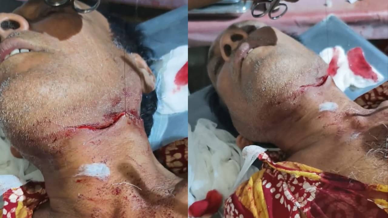 Arambagh: গোঘাটে তৃণমূল কর্মীর গলায় ধারাল অস্ত্রের কোপ, বিজেপি বলছে ‘সবটাই ওদের গোষ্ঠীদ্বন্দ্ব’