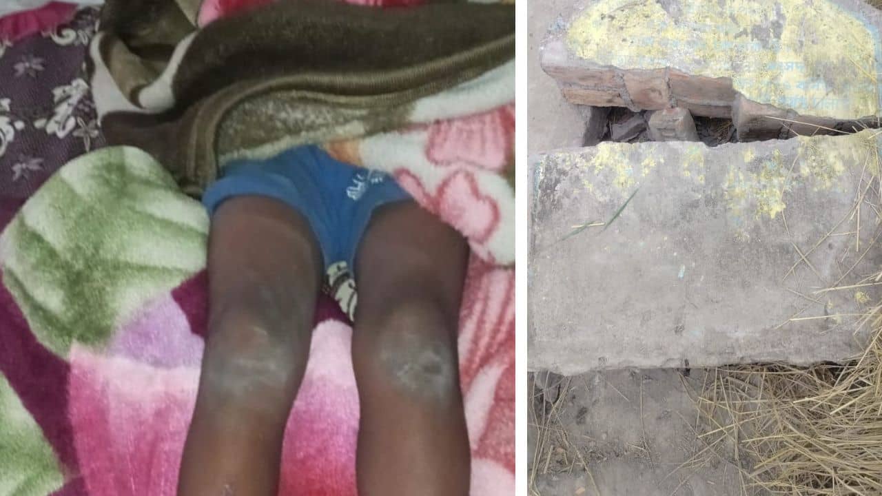 Sandeshkhali: বাড়ির সামনে খেলার সময় ভেঙে পড়ল ফলক, সন্দেশখালিতে জখম ৫ বছরের শিশু