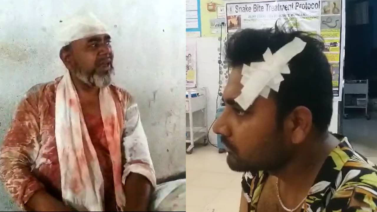 Tarakeswar: ব্যাগেই ওটা নিয়ে ঢুকেছিল শ্বশুর, দেখা হতেই যা হাল হল জামাইয়ের, সোজা হাসপাতালে দু’জনেই