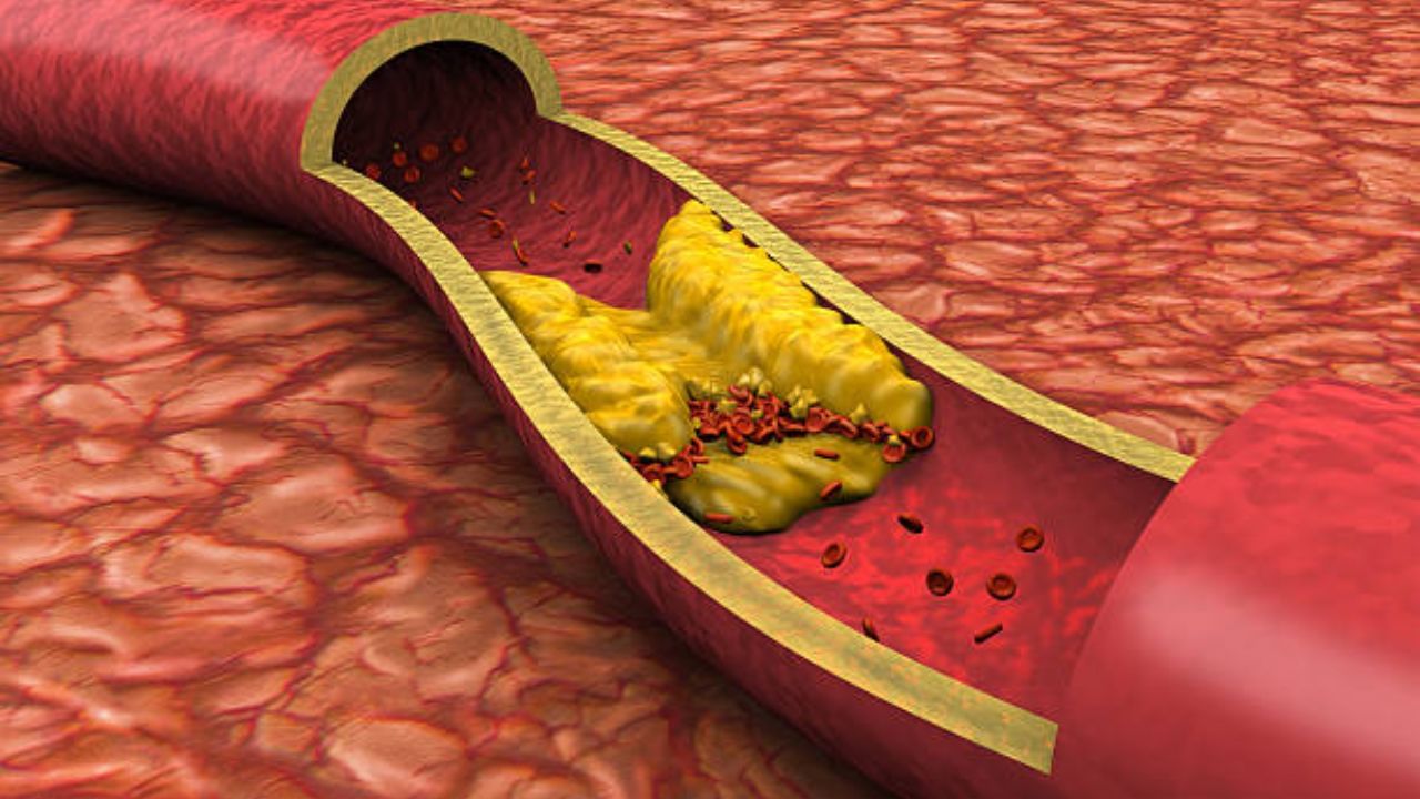High Cholesterol: গরমে চড়চড়িয়ে বাড়ে কোলেস্টেরল, এই ৪ ফল ও সবজি না খেলে হতে পারে হার্ট অ্যাটাক