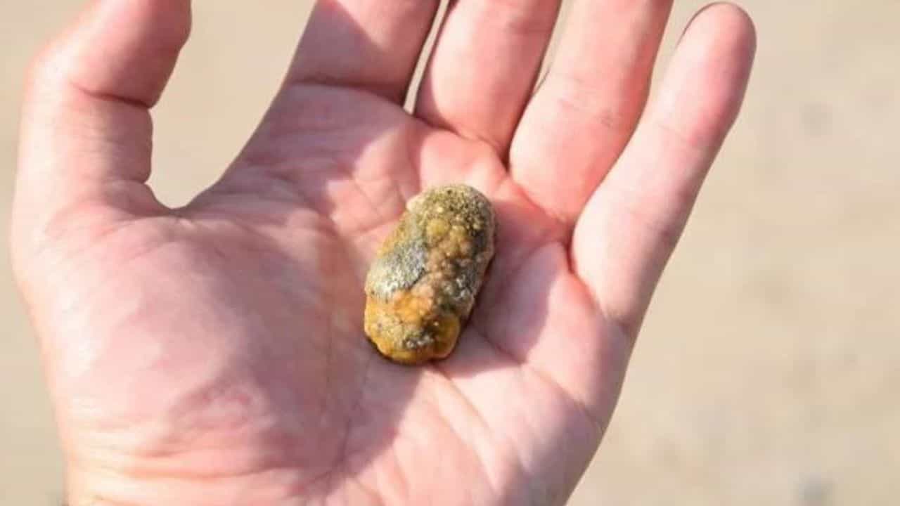 Gall Bladder Stone: গল ব্লাডার হলে কিংবা পিত্তথলিতে পাথর জমলে কী খাবেন, কেমনভাবে চলবেন? Gall Bladder Stone: গল ব্লাডার হলে কিংবা পিত্তথলিতে পাথর জমলে কী খাবেন, কেমনভাবে চলবেন?