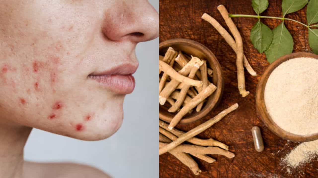 Ashwagandha for Skin: তাপমাত্রা বাড়তেই মুখ ভরেছে ব্রণতে? এই আয়ুর্বেদিক উপাদান ১ বার মাখলেই কমবে ত্বকের সমস্যা Ashwagandha for Skin: তাপমাত্রা বাড়তেই মুখ ভরেছে ব্রণতে? এই আয়ুর্বেদিক উপাদান ১ বার মাখলেই কমবে ত্বকের সমস্যা