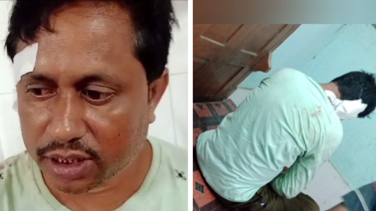 BJP Worker physically Harassed: বাজার সেরে বাড়ি ফেরার পথে কান কেটে নেওয়া হল BJP কর্মীর, অভিযুক্ত TMC BJP Worker physically Harassed: বাজার সেরে বাড়ি ফেরার পথে কান কেটে নেওয়া হল BJP কর্মীর, অভিযুক্ত TMC