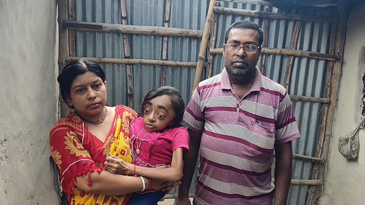Balurghat: শরীরের তুলনায় মাথা বড় চতুর্গুণ, উচ্চ মাধ্যমিকে ৯২ শতাংশ পেয়ে পায়েলের রুগ্ন হাত স্পর্শ করল আকাশ Balurghat: শরীরের তুলনায় মাথা বড় চতুর্গুণ, উচ্চ মাধ্যমিকে ৯২ শতাংশ পেয়ে পায়েলের রুগ্ন হাত স্পর্শ করল আকাশ