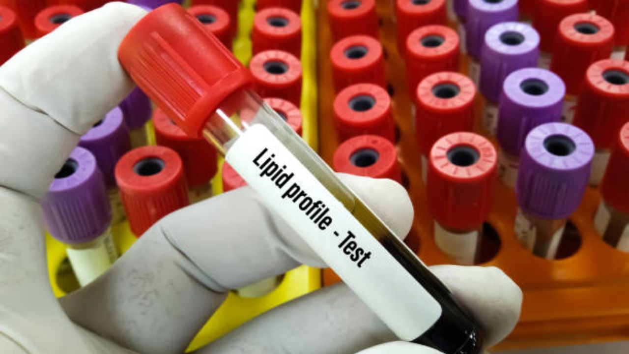 Cholesterol Test: ঘরে বসেই এভাবে কোলেস্টেরল টেস্ট করুন, ফল 100 mg/dl পেরোলেই ডাক্তারের কাছে ছুটুন Cholesterol Test: ঘরে বসেই এভাবে কোলেস্টেরল টেস্ট করুন, ফল 100 mg/dl পেরোলেই ডাক্তারের কাছে ছুটুন