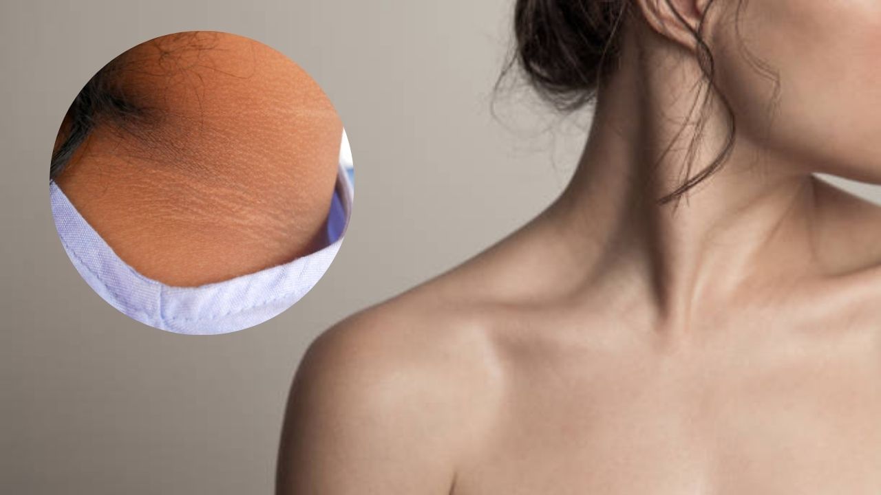 Dark Neck: ঘাড়ের বিচ্ছিরি ছোপ সৌন্দর্যের পথে বাধা হয়ে দাঁড়াচ্ছে? ৩ টোটকায় দূর করুন কালো দাগ Dark Neck: ঘাড়ের বিচ্ছিরি ছোপ সৌন্দর্যের পথে বাধা হয়ে দাঁড়াচ্ছে? ৩ টোটকায় দূর করুন কালো দাগ