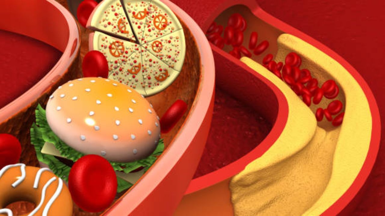 High Cholesterol: গরমে বাড়বাড়ন্ত কোলেস্টেরলের? চিকিৎসক ও পুষ্টিবিদের থেকে জেনে নিন মুক্তির উপায়