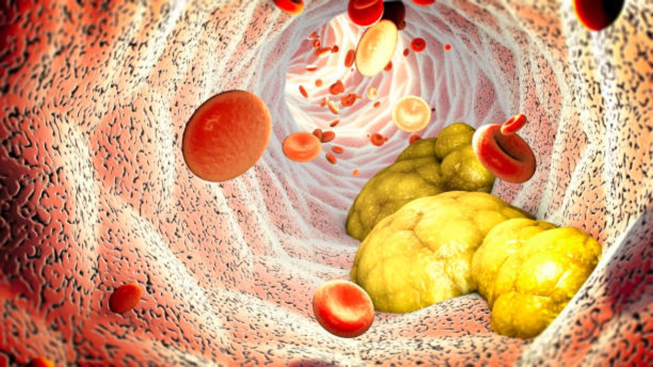 Good Cholesterol: ওষুধ খাচ্ছেন এলডিএল কমানোর জন্য, ভাল কোলেস্টেরলের মাত্রা বাড়াতে কী করবেন?