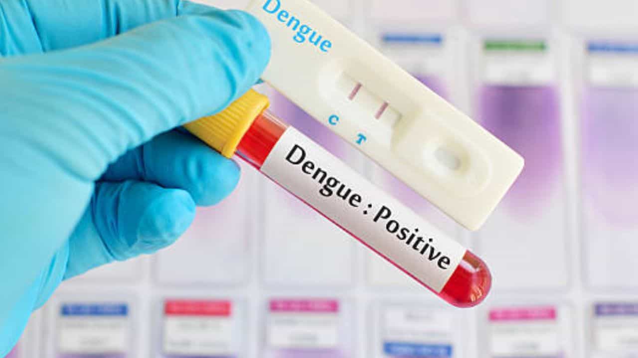 Dengue: ডেঙ্গি পরিস্থিতি ভাবাচ্ছে, পুরএলাকা ধরে সতর্ক করা হল... Dengue: ডেঙ্গি পরিস্থিতি ভাবাচ্ছে, পুরএলাকা ধরে সতর্ক করা হল...