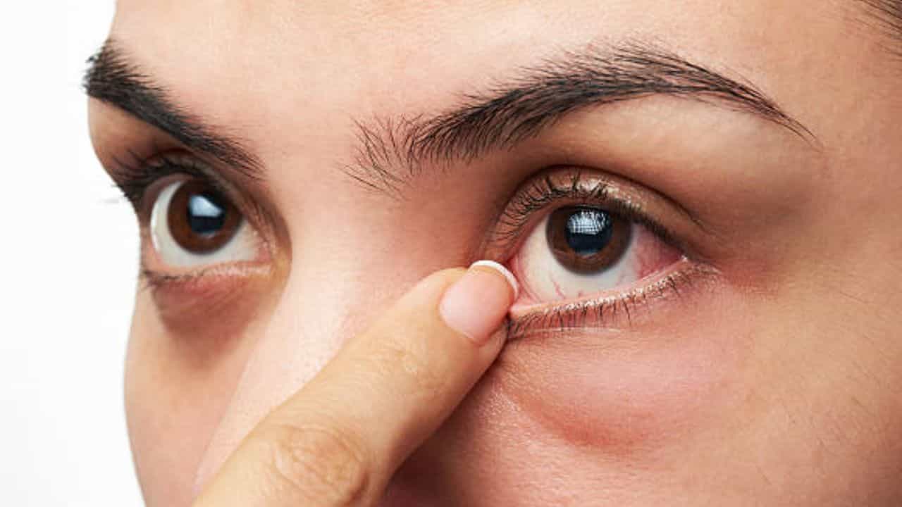 Dry Eyes Syndrome: প্রচণ্ড গরমে ড্রাই আই সিনড্রোমের সমস্যা হচ্ছে, এই রোগের উপসর্গ ও প্রতিকার কী? Dry Eyes Syndrome: প্রচণ্ড গরমে ড্রাই আই সিনড্রোমের সমস্যা হচ্ছে, এই রোগের উপসর্গ ও প্রতিকার কী?