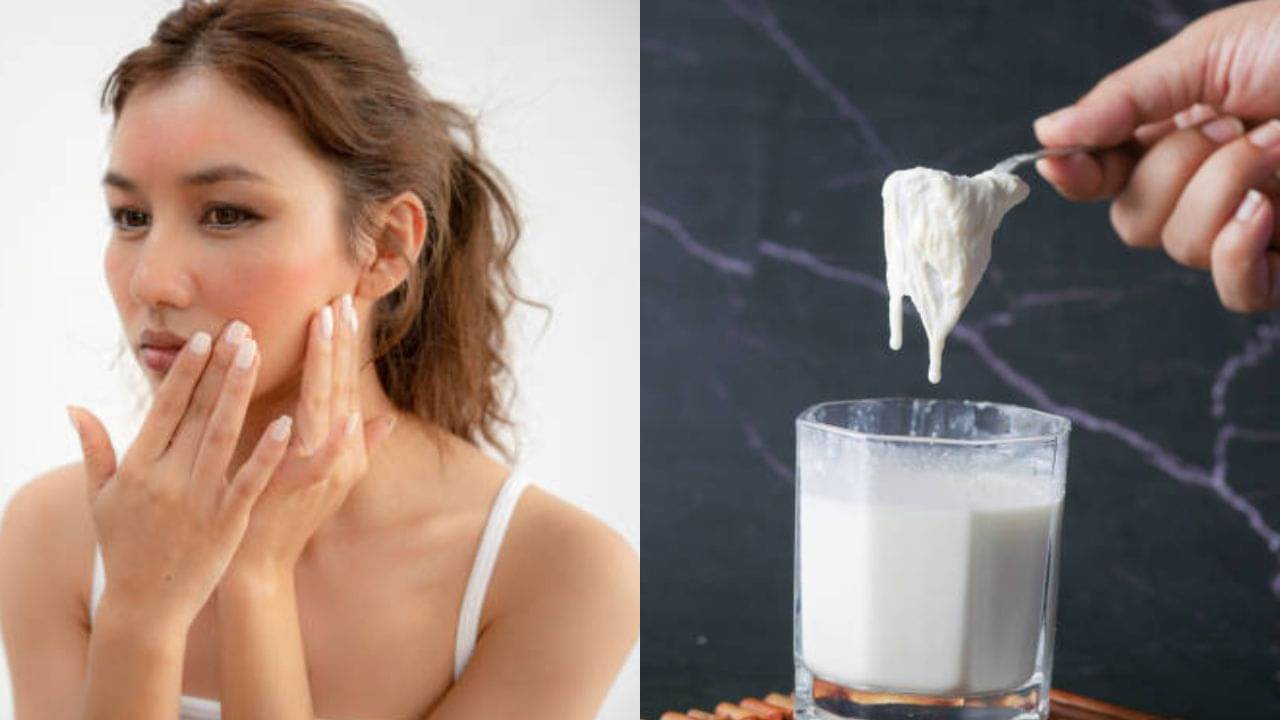 Malai for Skin Rashes: চুলকানি থেকে জ্বালাভাব—দুধের সর মাখলেই পাবেন নরম ত্বক