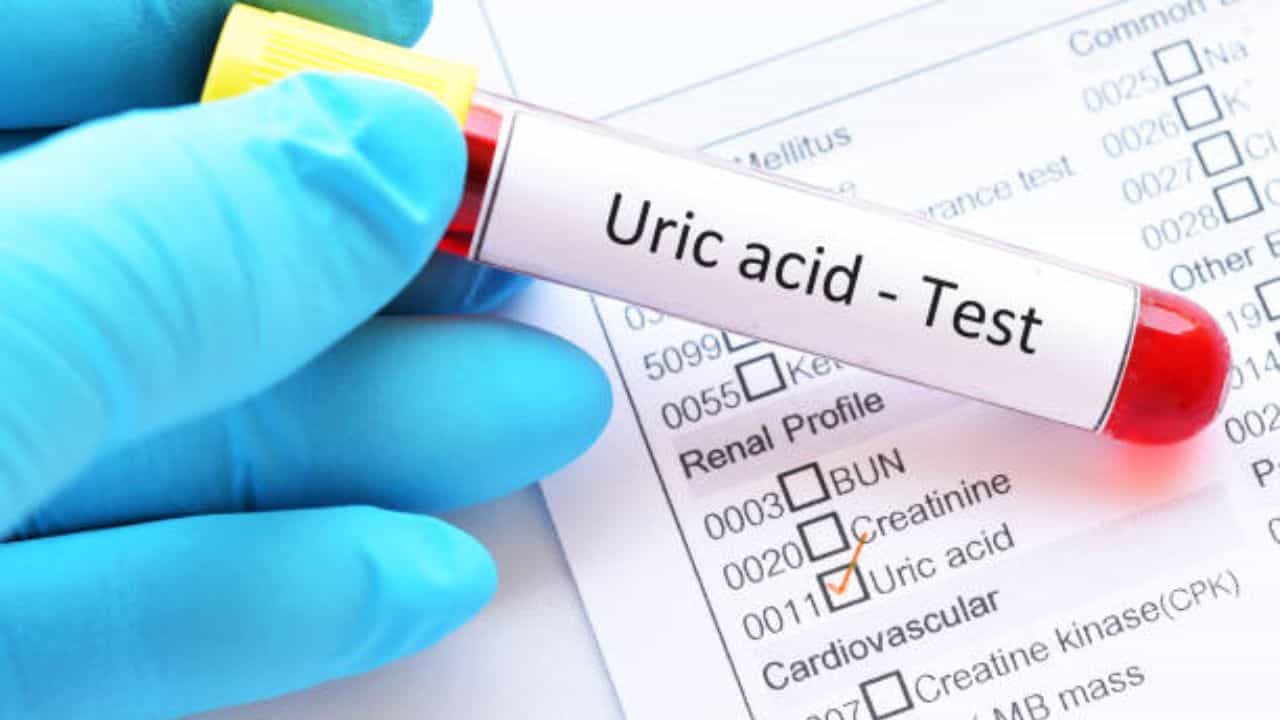 High Uric Acid: টেস্ট না করিয়েই বুঝতে পারবেন ইউরিক অ্যাসিড বেড়েছে, এড়িয়ে যাবেন না এই ৩ লক্ষণ High Uric Acid: টেস্ট না করিয়েই বুঝতে পারবেন ইউরিক অ্যাসিড বেড়েছে, এড়িয়ে যাবেন না এই ৩ লক্ষণ