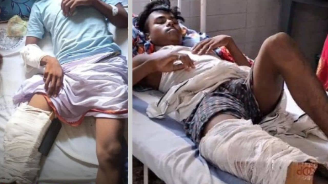ভাঙা পায়ে প্লাস্টারের বদলে বাঁধা কার্ডবোর্ড! সরকারি হাসপাতালে ৫ দিন এভাবেই পড়ে রইলেন যুবক