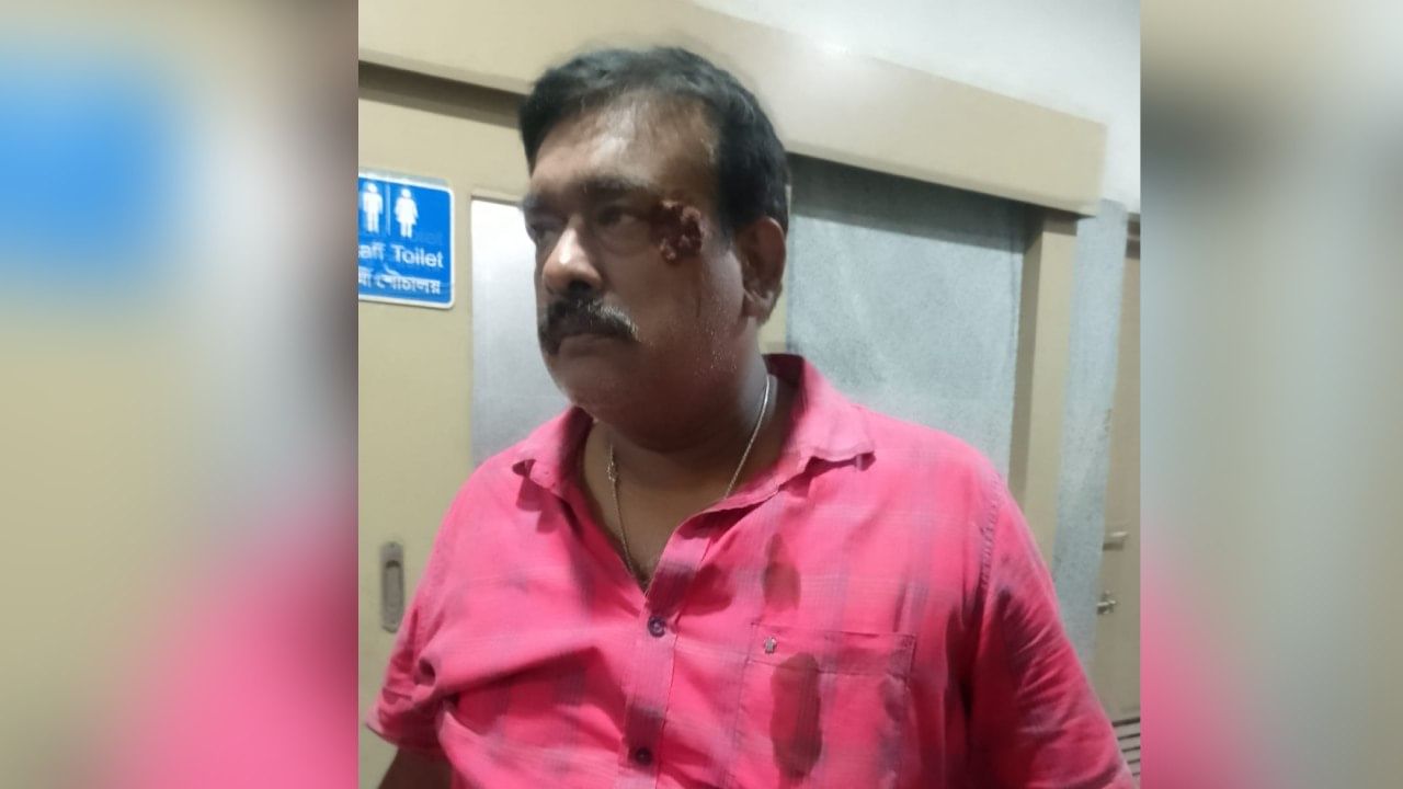 TMC: খাস কলকাতায় ফের শাসকদলের গোষ্ঠী কোন্দল? কান ফাটল কাউন্সিলরের TMC: খাস কলকাতায় ফের শাসকদলের গোষ্ঠী কোন্দল? কান ফাটল কাউন্সিলরের