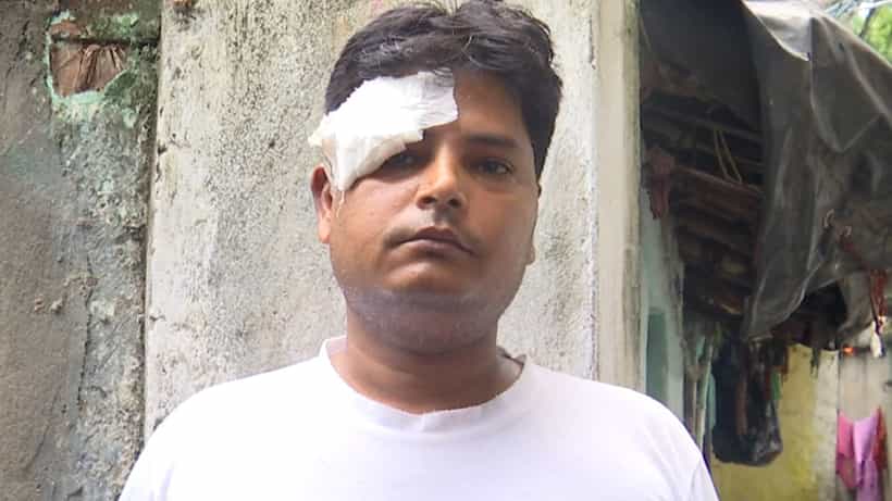 Post Poll Violence: তাপস রায়ের এজেন্টকে মেরে চোখের কোণ ফাটিয়ে দেওয়ার অভিযোগ, টলিগঞ্জে আক্রান্ত কলেজ পড়ুয়া