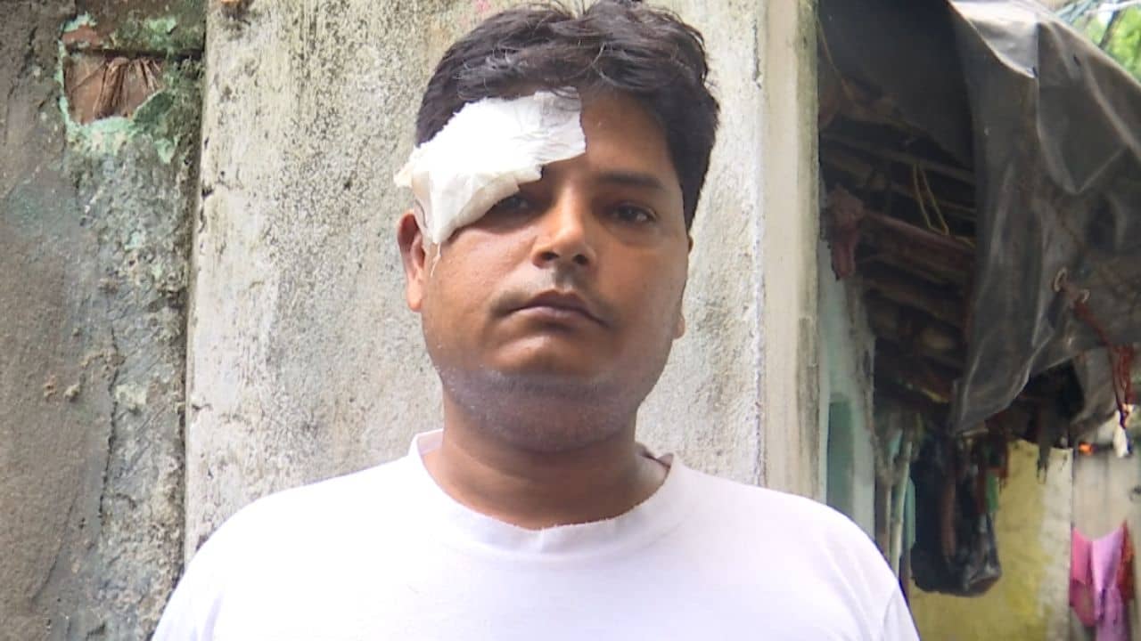 Post Poll Violence: তাপস রায়ের এজেন্টকে মেরে চোখের কোণ ফাটিয়ে দেওয়ার অভিযোগ, টলিগঞ্জে আক্রান্ত কলেজ পড়ুয়া