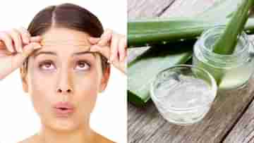 Aloe Vera for Wrinkles: কপালের ভাঁজ এড়াতে অ্যালোভেরাই যথেষ্ট, রোজ মাখলে কাছে ঘেঁষবে না বলিরেখা