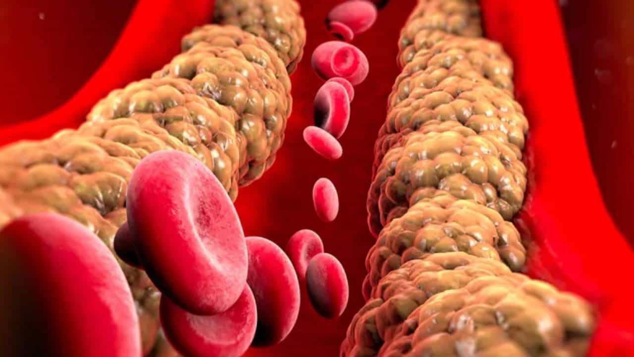 High Cholesterol: গ্রাম্য ফল আর এই মশলার যুগলবন্দিতে জব্দ হবে কোলেস্টেরল, খেতে হবে না ওষুধ High Cholesterol: গ্রাম্য ফল আর এই মশলার যুগলবন্দিতে জব্দ হবে কোলেস্টেরল, খেতে হবে না ওষুধ
