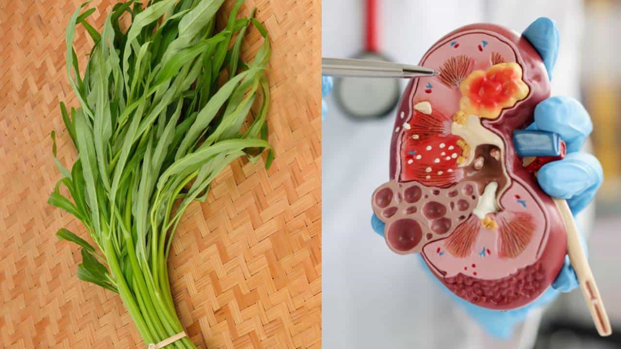 Kidney Stone: কিডনির স্টোন গলিয়ে বের করে দেবে এই শাক Kidney Stone: কিডনির স্টোন গলিয়ে বের করে দেবে এই শাক