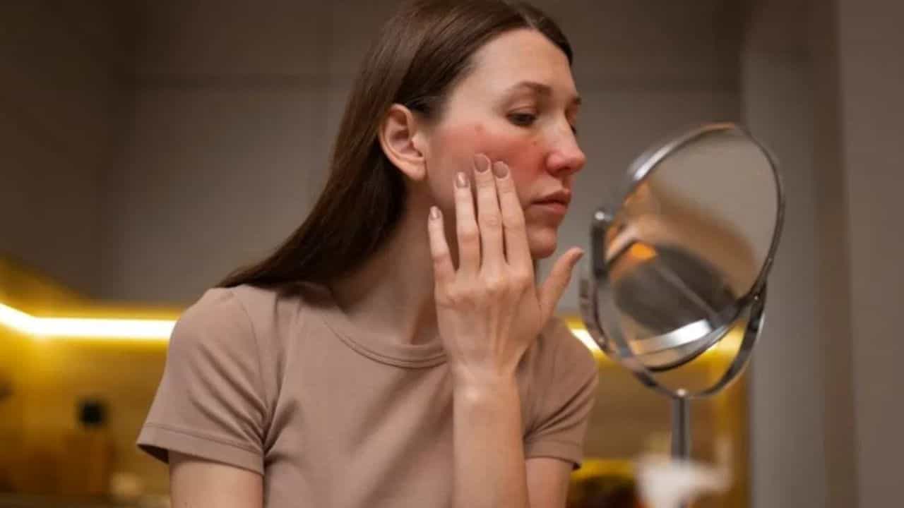 Skin Care Tips: গরমে হতে পারে ত্বকের ৪ সমস্যা, কীভাবে এড়াবেন? Skin Care Tips: গরমে হতে পারে ত্বকের ৪ সমস্যা, কীভাবে এড়াবেন?