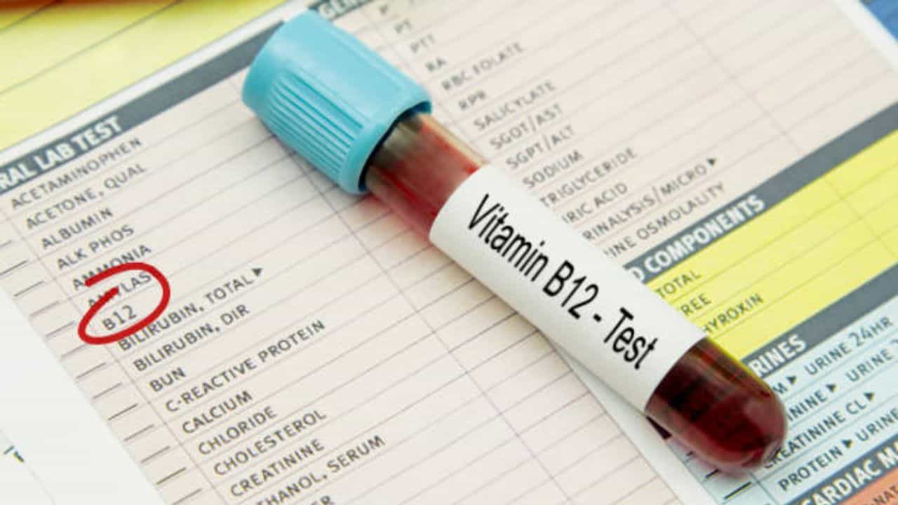 Vitamin B12: শরীর খুব দুর্বল, সারাদিন ধরে ঘুম পায়? দেহে ভিটামিন বি১২-এর ঘাটতি নেই তো? Vitamin B12: শরীর খুব দুর্বল, সারাদিন ধরে ঘুম পায়? দেহে ভিটামিন বি১২-এর ঘাটতি নেই তো?