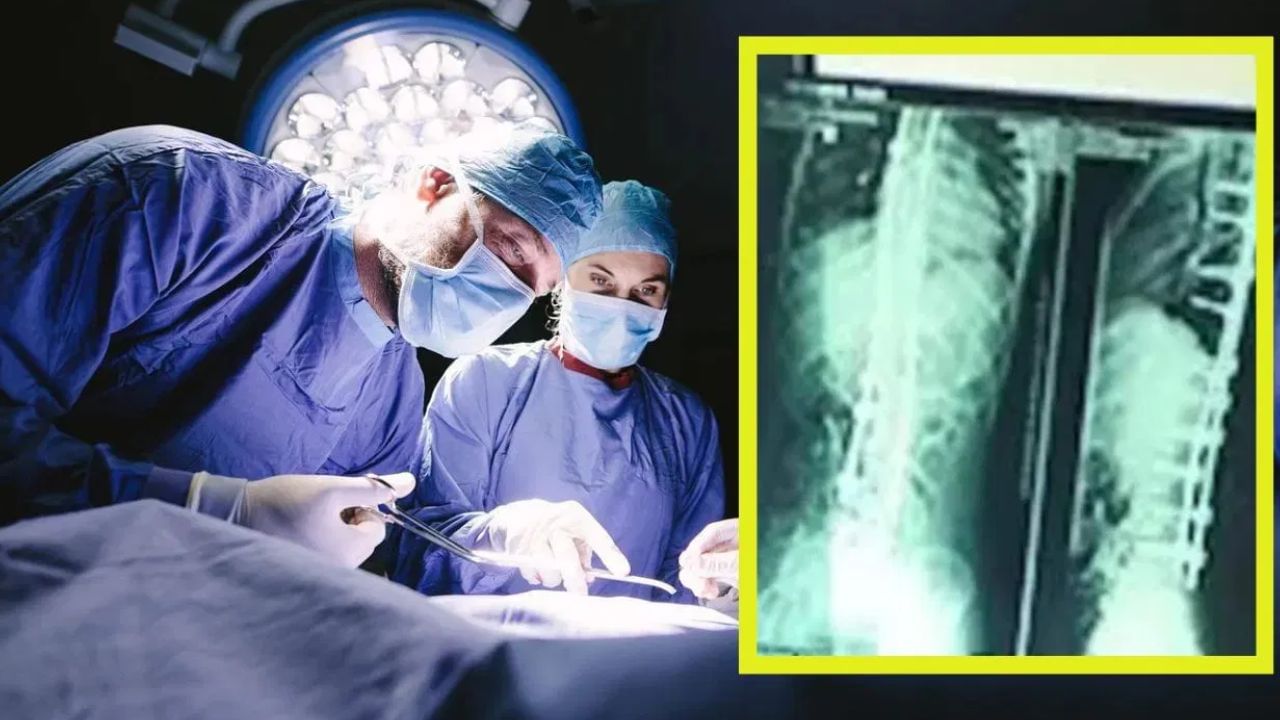 Appendix Operation: অ্যাপেনডিক্স অপারেশনের পর থেকেই প্রবল যন্ত্রণা, ৬ বছর পর পদ্মাবতীর পেটে স্ক্যান করতেই এ কী দেখলেন ডাক্তাররা! Appendix Operation: অ্যাপেনডিক্স অপারেশনের পর থেকেই প্রবল যন্ত্রণা, ৬ বছর পর পদ্মাবতীর পেটে স্ক্যান করতেই এ কী দেখলেন ডাক্তাররা!
