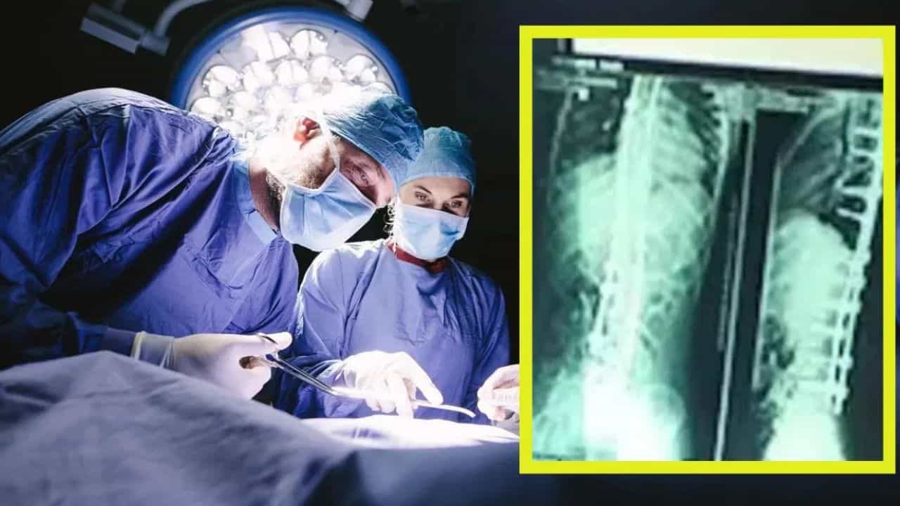 Appendix Operation: অ্যাপেনডিক্স অপারেশনের পর থেকেই প্রবল যন্ত্রণা, ৬ বছর পর পদ্মাবতীর পেটে স্ক্যান করতেই এ কী দেখলেন ডাক্তাররা! Appendix Operation: অ্যাপেনডিক্স অপারেশনের পর থেকেই প্রবল যন্ত্রণা, ৬ বছর পর পদ্মাবতীর পেটে স্ক্যান করতেই এ কী দেখলেন ডাক্তাররা!